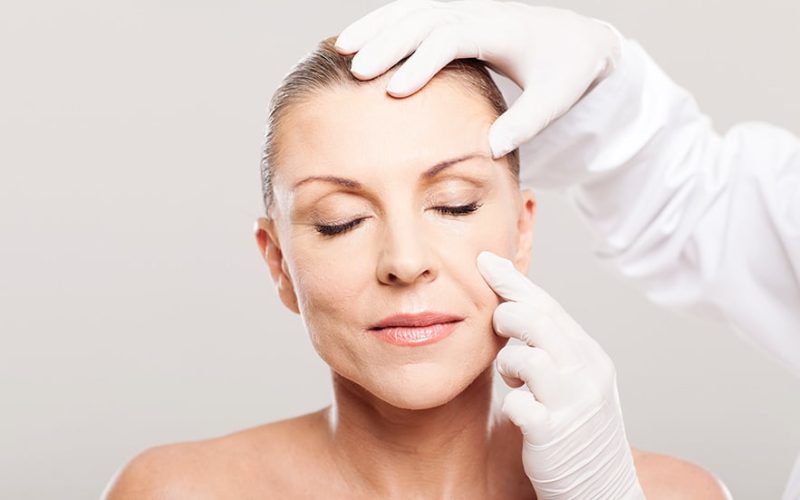 blepharoplasty-image